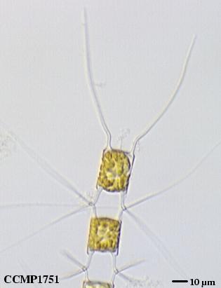 CCMP1751 | NCMA at Bigelow Laboratory